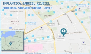 CHIRURGIA STOMATOLOGICZNA - IMPLANTICA GABRIEL CZUBIEL - LEONA WYCZÓŁKOWSKIEGO 21,  OPOLE